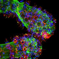 <I>Hydra magnipapillata</I> Tentacle Stained for Opsin