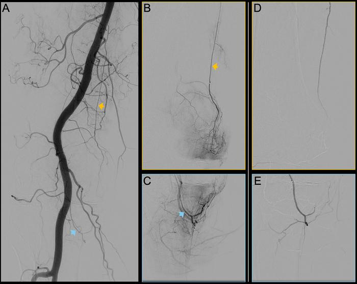 Angiography images of the right knee joint