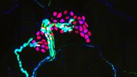 Colorful Merkel Cell
