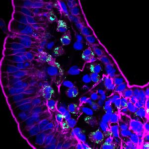 Fluorescence confocal microscopy image