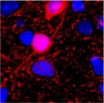 Brain Cell Activity Imbalance May Account for Seizure Susceptibility in Angelman Syndrome