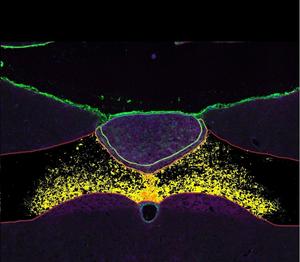 Microscopic view of the hindbrain