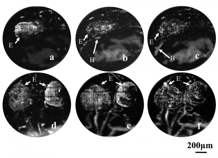 Vascular Development in Zebrafish