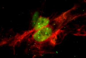 Bivalent neurons