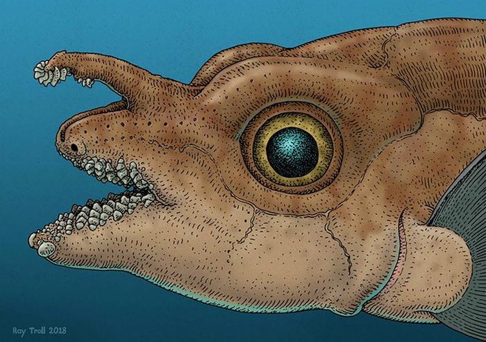 Erect tenaculum illustration