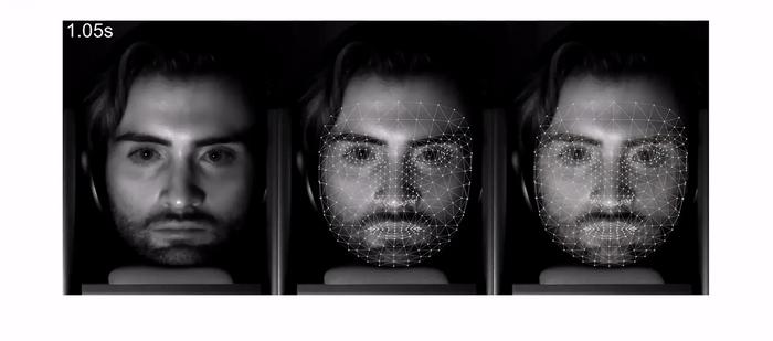 Tinnitus biomarkers video capture