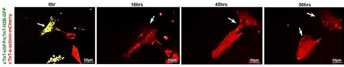 Heart Cell Muscle Dividing Captured on Image from Live Microscopy.