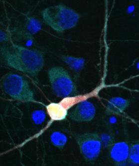 Cell with TDP43 and hUFP1