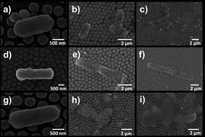 SEM Images of <i>E. coli</i>