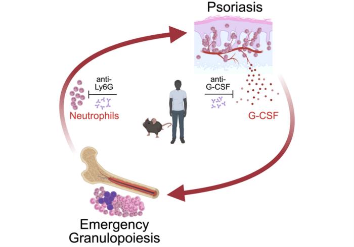 glutathione helps psoriasis Skin-bone marrow axis discovery opens new doors for treatment #GlutathionBrightening Vitamin C and peptides: Please select your glutathione flavor:Cacao Mint