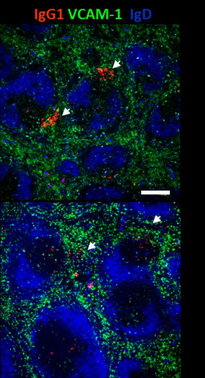 Plasma Cells Provide the First Hint