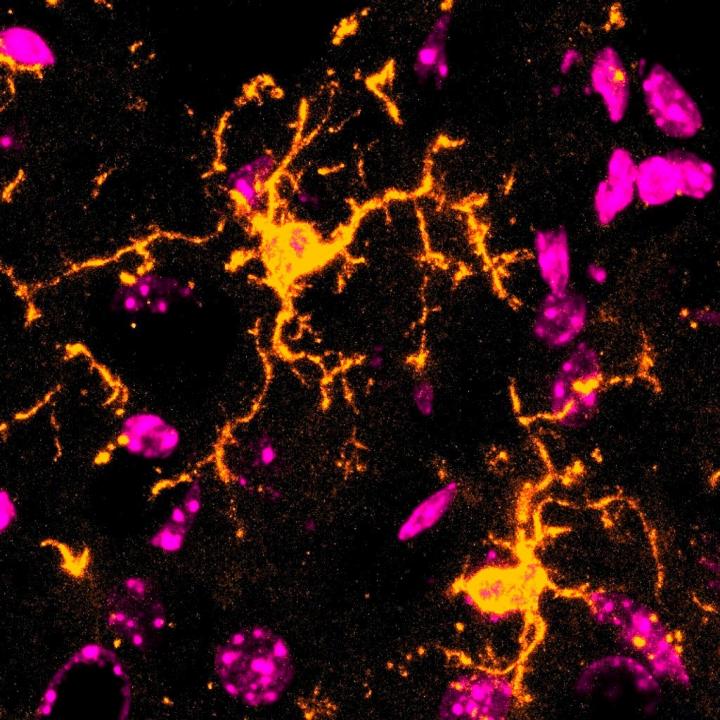 Confocal Microscopy Image of Microglia