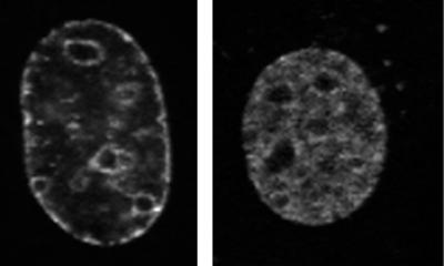 Lamin B Mutant Cell