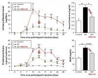 MES+HS ameliorates abnormalities in urinary and blood renal function parameters in ADR-induced NS