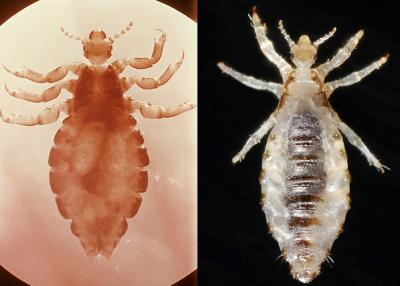 Head Louse Versus Body Louse