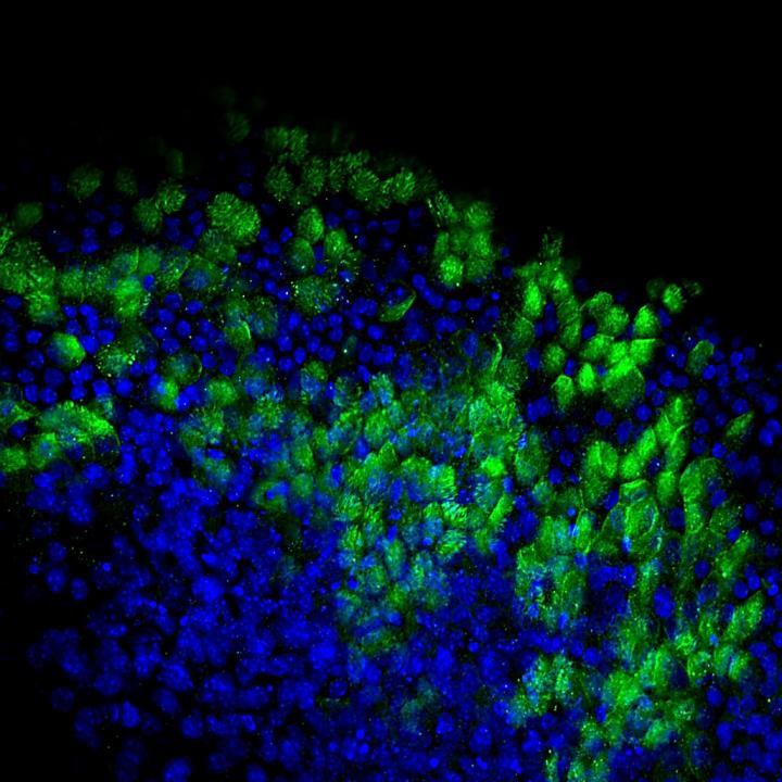 Ciliated Epithelium