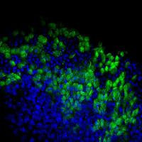 Ciliated Epithelium