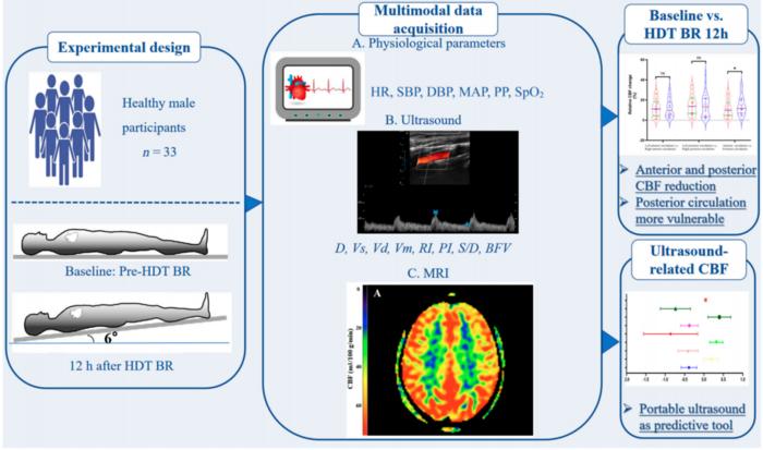 Fig. 1. Schematic diagram of the research process. Thirty-three healthy male participants underwent a 12-h –6° head-down tilt (HDT) bed rest (BR) protocol to simulate microgravity exposure.