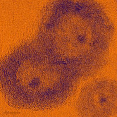 'Eggshell-and-yolk' Nanostructures