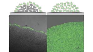 At high cell density (center of colony at left), Y. enterocolitica switches off the T3SS (green). If this mechanism is missing, the T3SS is active in all bacteria (right). (Illustration: Andreas Diepold, KIT)
