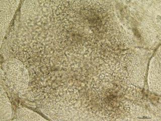 Cardiomyocyte