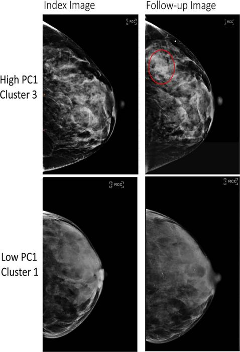 Full-field digital mammography (FFDM) images