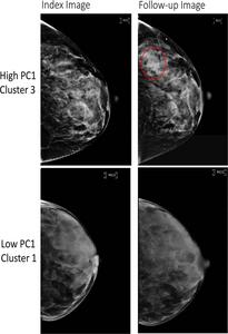 Full-field digital mammography (FFDM) images