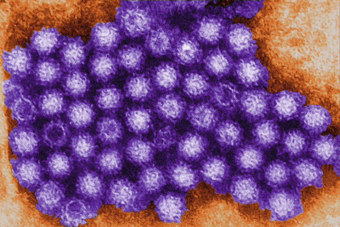 Norovirus Micrograph