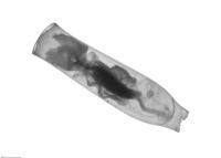 BIOS ZooScan-Pteropod