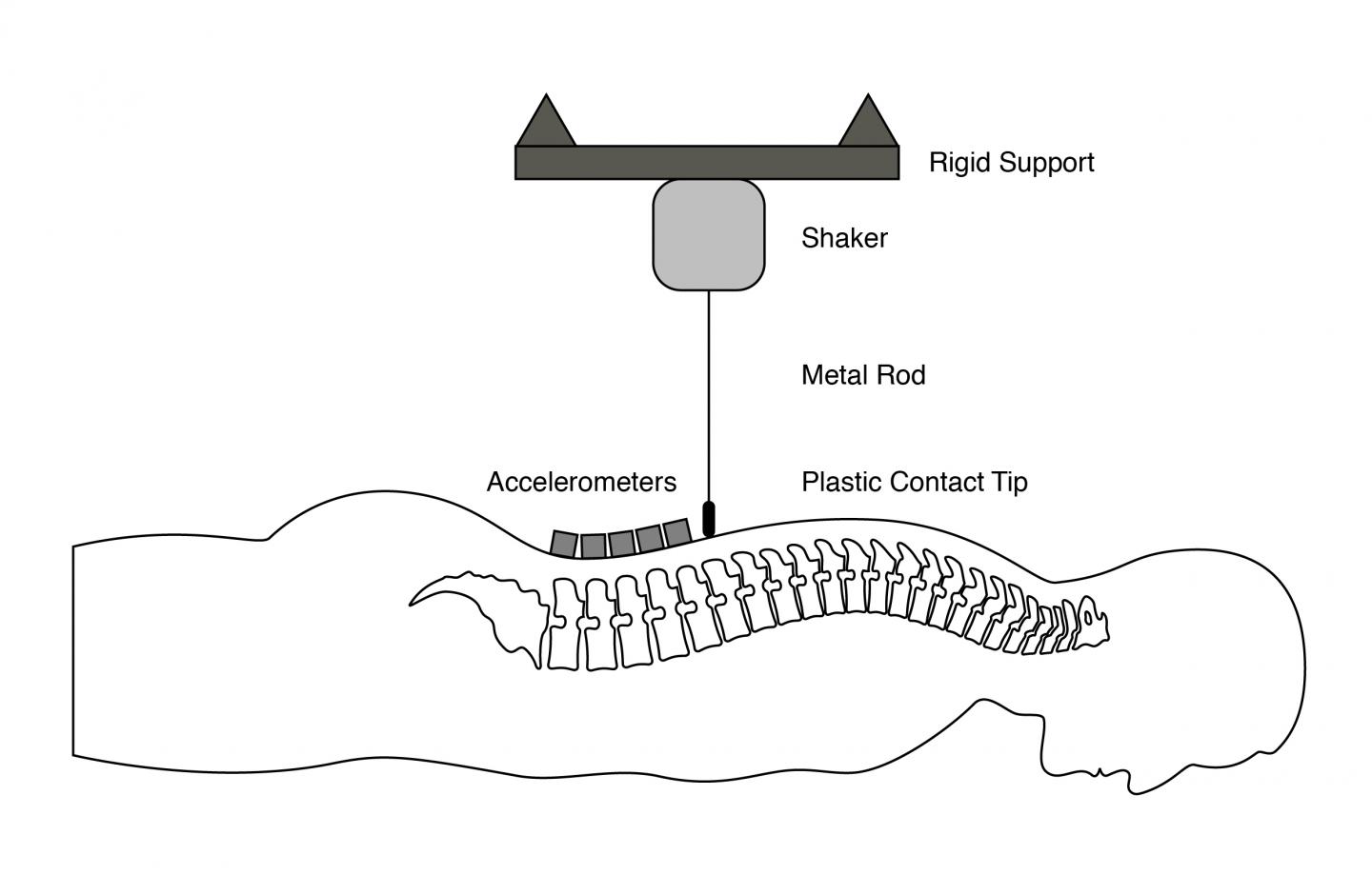 Spinal Vibration