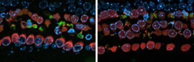 Hair Cells and Antibiotic Effects