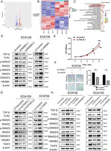 HMGB3 and TGIF2 activate TGF-β signaling in esophageal squamous cell carcinoma (ESCC)