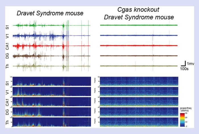 Brain activity traces recorded from different brain regions show frequent seizure-like activity in Dravet mouse models (left), while Dravet moouse models with genetically reduced cGAS (right) show fewer seizure-like events