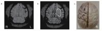 Whole Brain Imaging of a Monkey's Brain with Ischemia