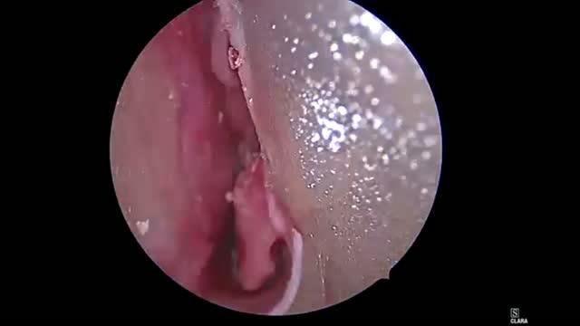 Endscopic images of a 3D sinus model