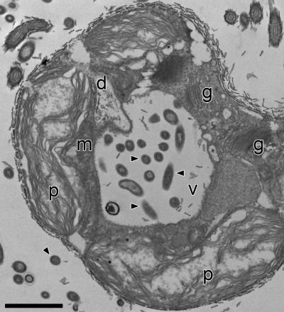 Green Alga Micrograph