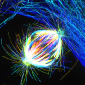 A metaphase spindle in a healthy human cell,