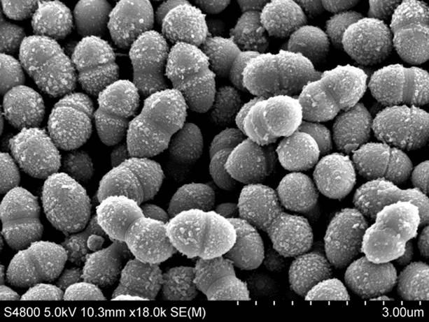 Scientists Find New Variant of Streptococcal Bacteria Causing Severe Infections