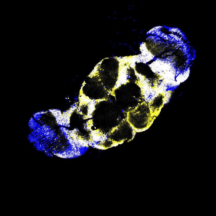 Microscopy image of fly brain