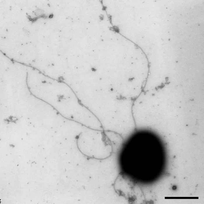 H. marismortui EM micrograph