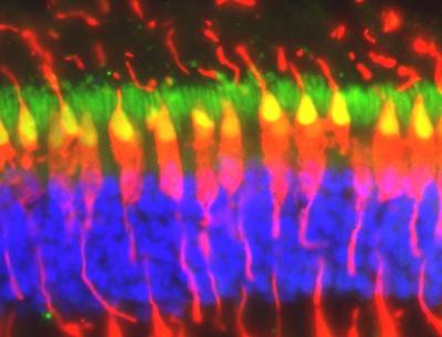 Retina