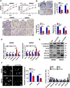 Ectopic expression of CLCA4 induced reduced proliferation, invasion, motility, and stem cell-like properties of colorectal cancer (CRC) cells.