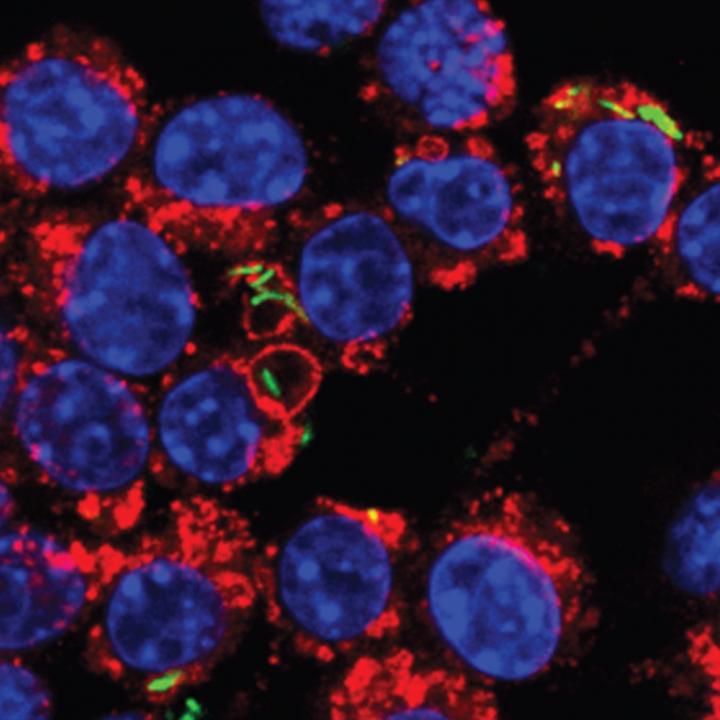 Macrophages Trapping TB Bacteria