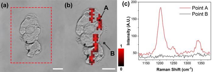 Breast cancer cell analysis