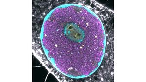 Nucleolar structure in parvovirus-infected cell
