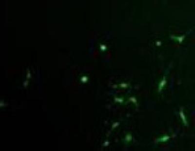 Irradation