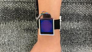 Photoacoustic imaging system in use