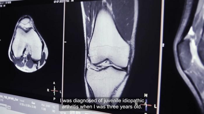 MAP-JAG Juvenile Idiopathic Arthritis study including case study