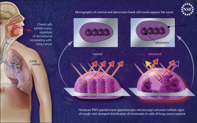 Lung Cancer Detection