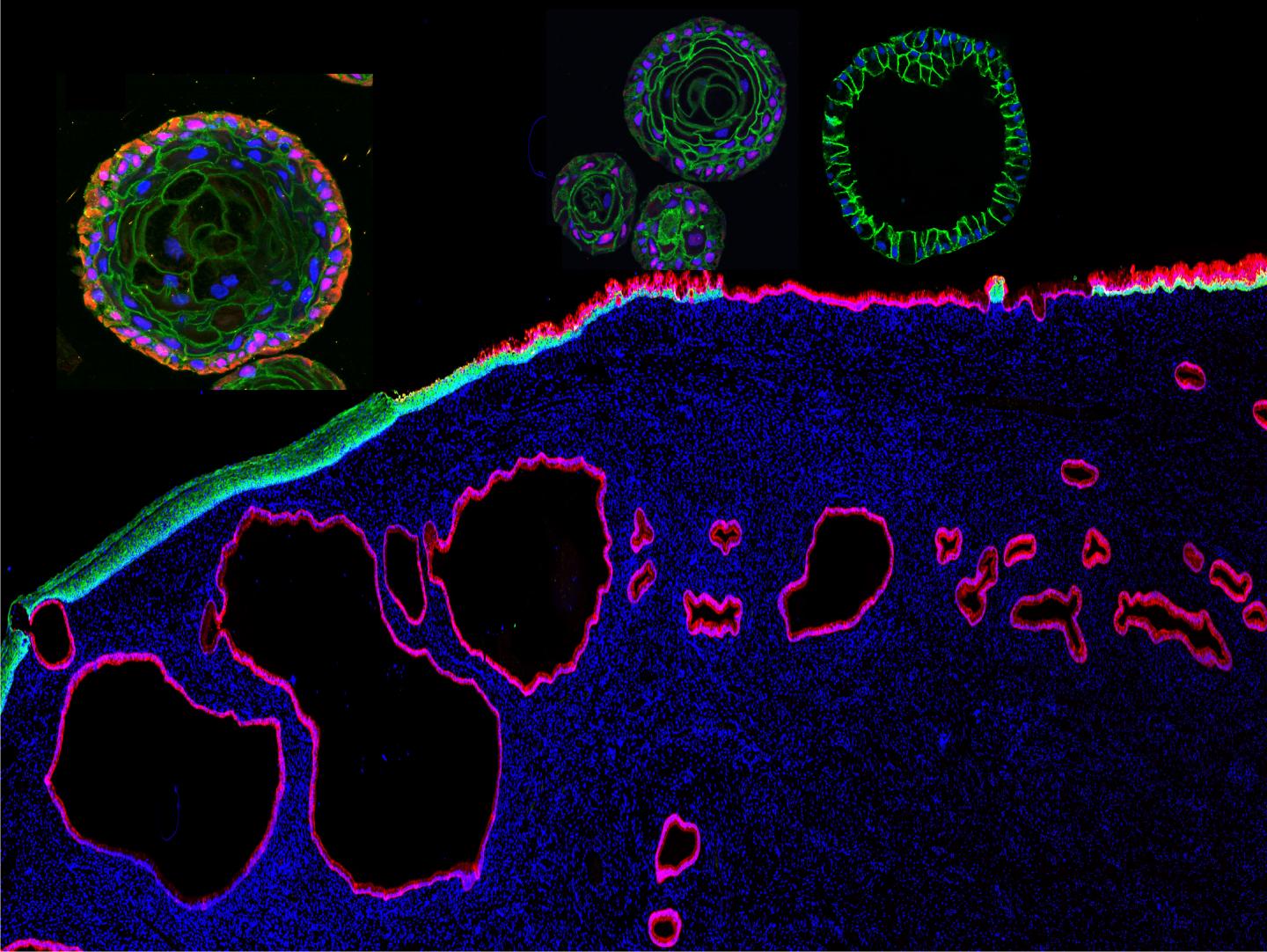 Cervix Organoids